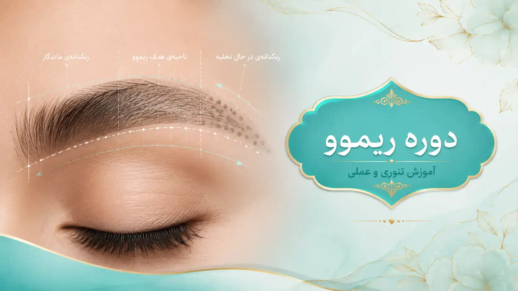دوره ریموو